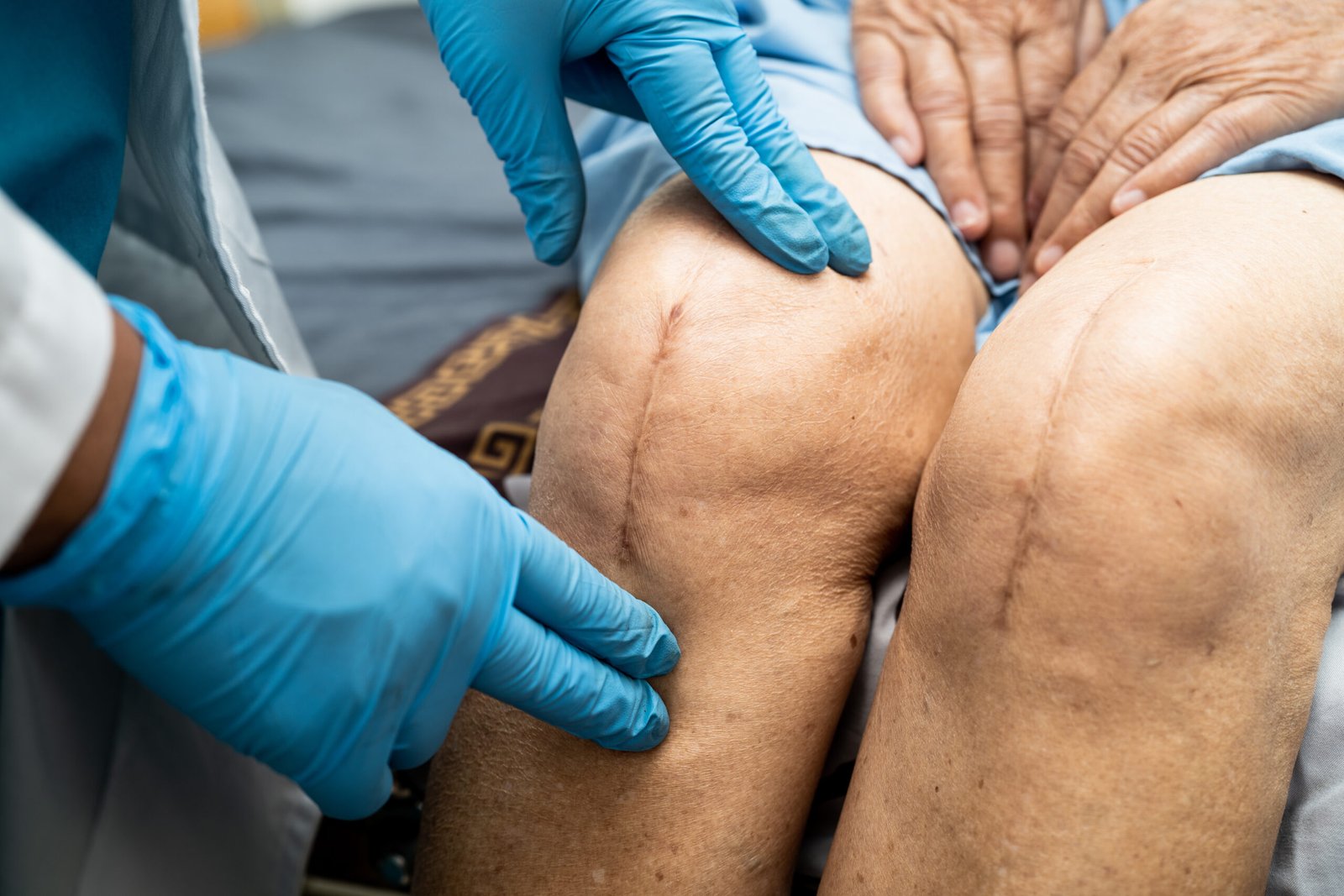knee replacement surgeon in Whitefield