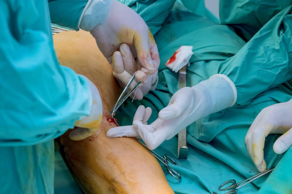 knee replacement surgery in Whitefield